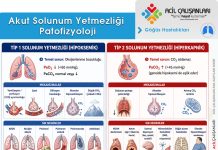 Akut Solunum Yetmezliği Acil Yaklaşım