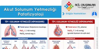 Akut Solunum Yetmezliği Acil Yaklaşım
