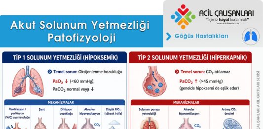 Akut Solunum Yetmezliği Acil Yaklaşım