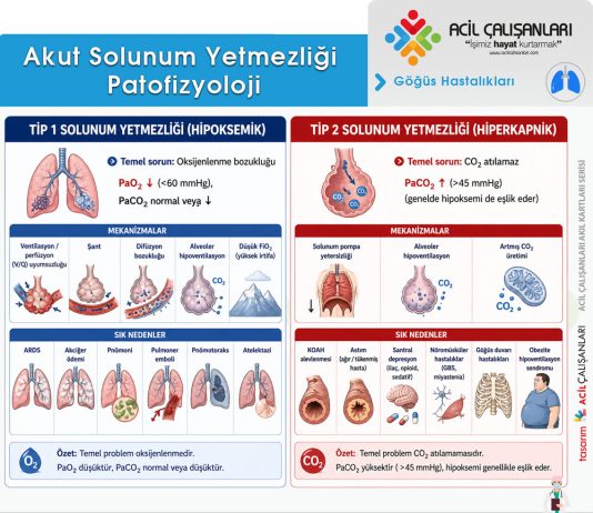 Akut Solunum Yetmezliği Acil Yaklaşım