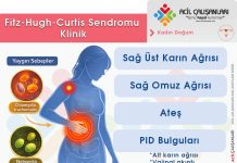 Fitz-Hugh-Curtis Sendromu