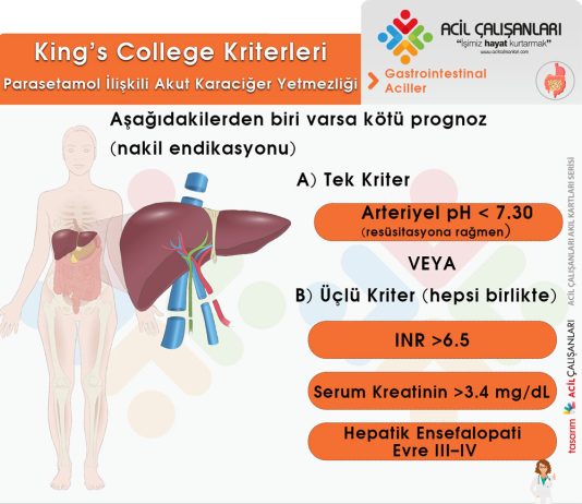 King’s College Kriterleri (Akut Karaciğer Yetmezliği)