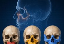 Le Fort Kırık Sınıflaması