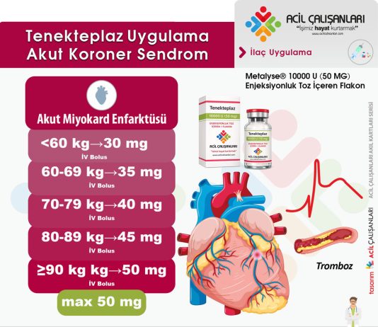 Tenekteplaz Uygulama