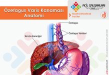 Özefagus Varis Kanaması