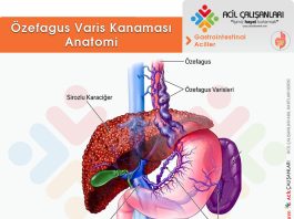 Özefagus Varis Kanaması