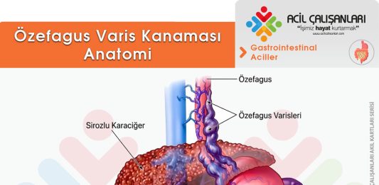 Özefagus Varis Kanaması