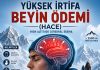 Yüksek İrtifa Beyin Ödemi (HACE)