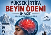Yüksek İrtifa Beyin Ödemi (HACE)