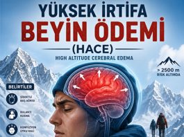Yüksek İrtifa Beyin Ödemi (HACE)