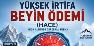 Yüksek İrtifa Beyin Ödemi (HACE)
