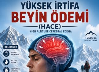 Yüksek İrtifa Beyin Ödemi (HACE)