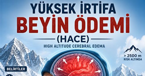 Yüksek İrtifa Beyin Ödemi (HACE)