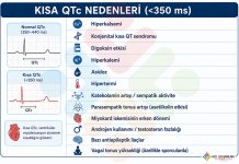 Kısa QT Nedenleri