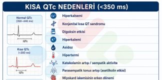 Kısa QT Nedenleri