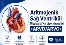 Aritmojenik Sağ Ventrikül Displazisi/Kardiyomiyopatisi (ARVD/ARVC)