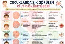 Çocuklarda Sık Görülen Cilt Döküntüleri