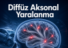 Diffüz Aksonal Yaralanma
