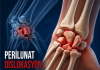 Perilunat Dislokasyon