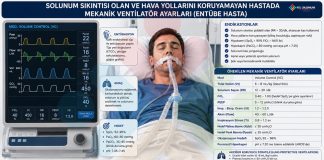 Suda Boğulmada Entübasyon Sonrası Mekanik Ventilasyon