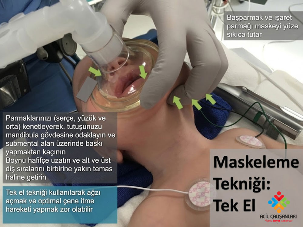 Ambu pediatri