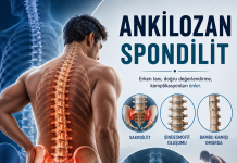 Ankilozan Spondilit: Acil Serviste Tanıma, Ayırıcı Tanı ve Yönetim