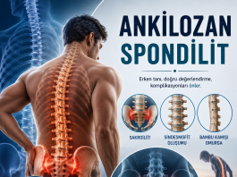 Ankilozan Spondilit: Acil Serviste Tanıma, Ayırıcı Tanı ve Yönetim
