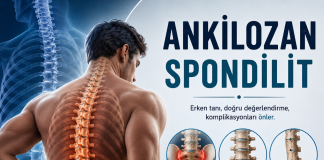 Ankilozan Spondilit: Acil Serviste Tanıma, Ayırıcı Tanı ve Yönetim