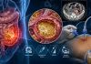 İntraabdominal Apse Acil Yaklaşım