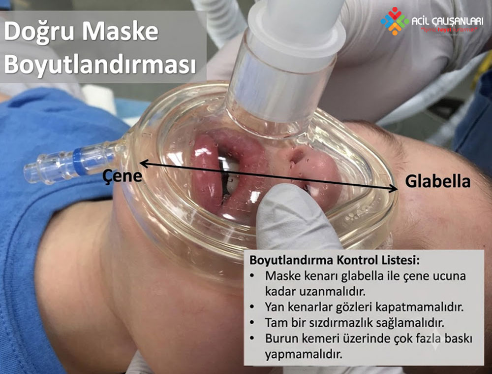 Pediatrik maske yerleşimi