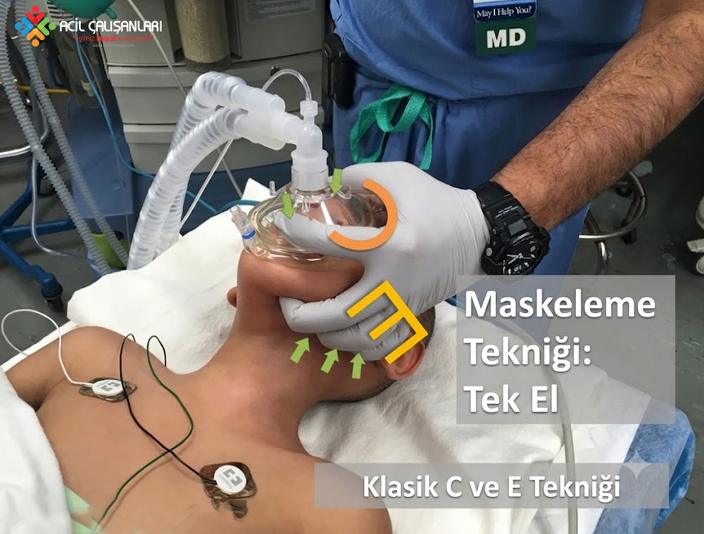 Pediatrik maske tekniği