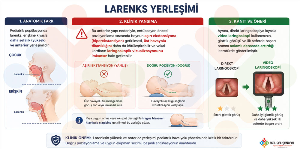 Pediatrik larenks yerleşimi