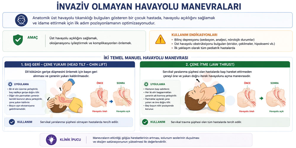 Pediatrik invaziv olmayan havayolu manevraları