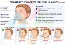 Pediatrik Maske Yerleştirme Tekniği