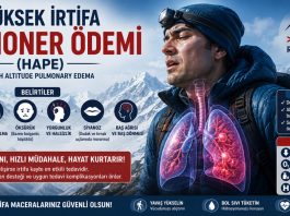 Yüksek İrtifa Pulmoner Ödemi (HAPE)