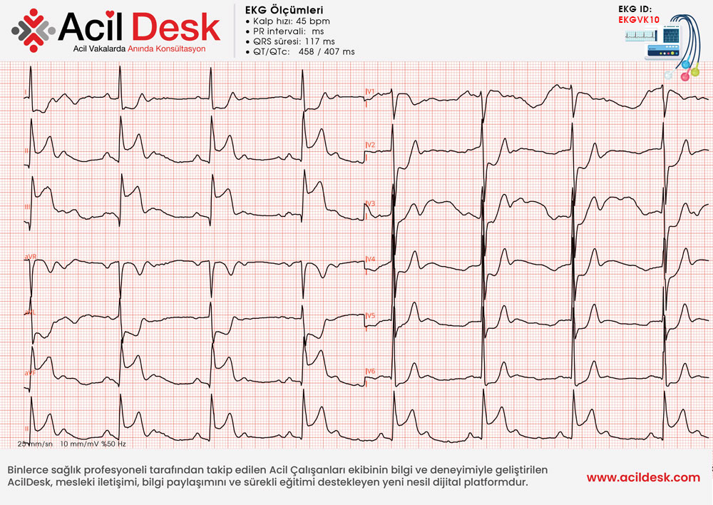 Başvuru EKG'si