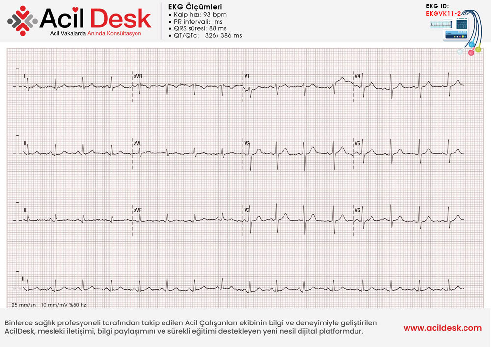 Kontrol EKG