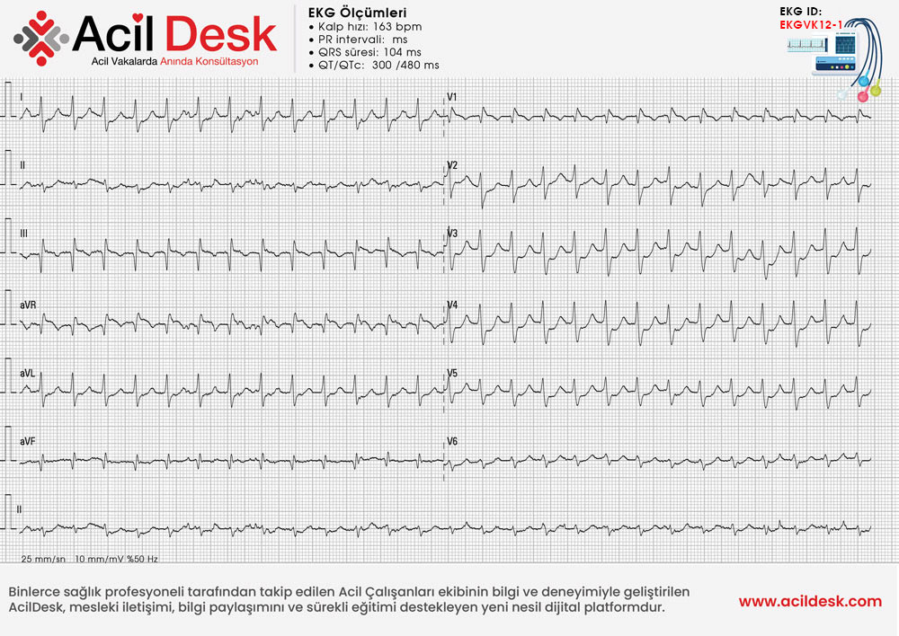 Başvuru EKG'si