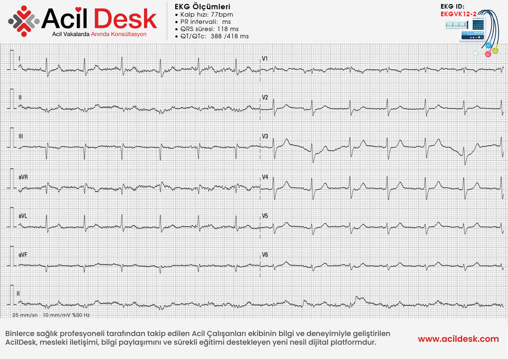 Kontrol EKG