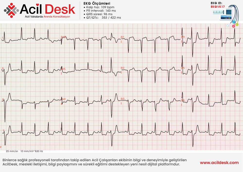 Başvuru EKG'si