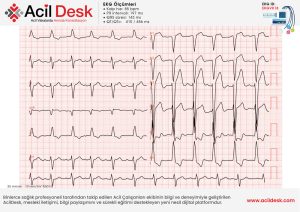 EKGVK18