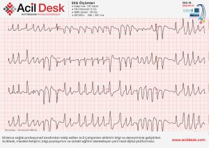 EKGVK19