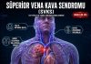 Süperior Vena Kava Sendromu (SVKS)