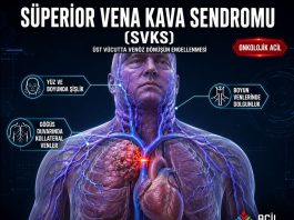 Süperior Vena Kava Sendromu (SVKS)