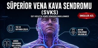 Süperior Vena Kava Sendromu (SVKS)