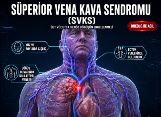 Süperior Vena Kava Sendromu (SVKS)